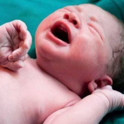 Photo of a Baby’s Birth Moment Goes Viral Worldwide