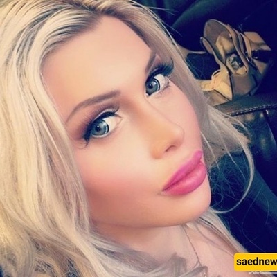 A Woman’s Extreme Surgeries to Achieve the Smallest Waist in the World