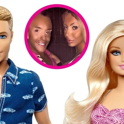 Couple Undergoes 15 Surgeries to Transform into Real-Life Barbie and Ken