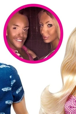 Couple Undergoes 15 Surgeries to Transform into Real-Life Barbie and Ken