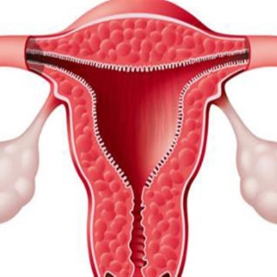 How is Sexual Intercourse Performed After a Hysterectomy?