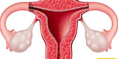 How is Sexual Intercourse Performed After a Hysterectomy?