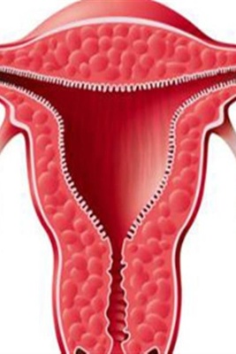 How is Sexual Intercourse Performed After a Hysterectomy?