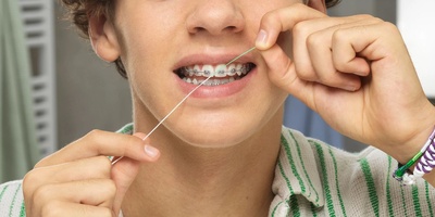 How to Floss With Braces Without Getting Tangled in the Wires