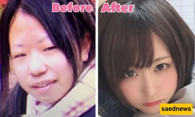 Unbelievable Transformation: Japanese Girl's Stunning Before-and-After Plastic Surgery Journey