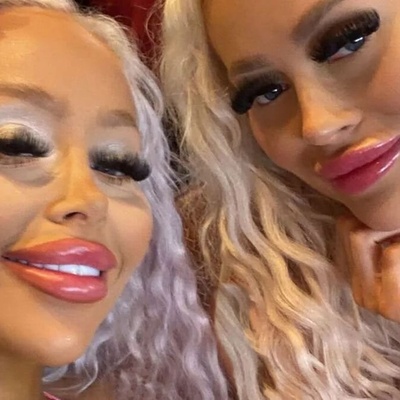Twins Who Spent Thousands to Look Like Barbie—And Their Transformation Isn’t Over Yet!