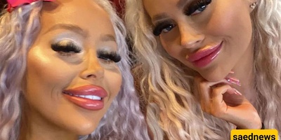 Twins Who Spent Thousands to Look Like Barbie—And Their Transformation Isn’t Over Yet!
