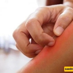 Do You Know the Trick to Keep Mosquitoes Away from Yourself?