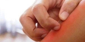 Do You Know the Trick to Keep Mosquitoes Away from Yourself?