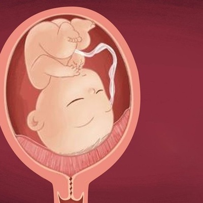 Understanding Marginal Placenta or Placenta Previa in Pregnancy