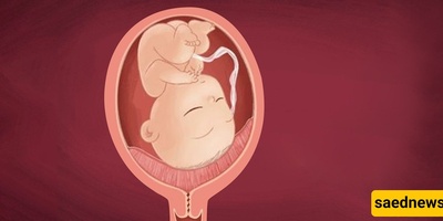 Understanding Marginal Placenta or Placenta Previa in Pregnancy