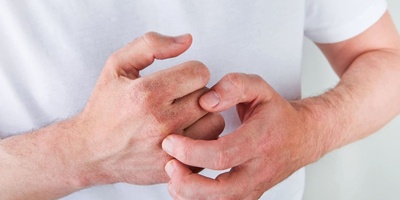 10 Best Natural Oils for Eczema Relief and Skin Care