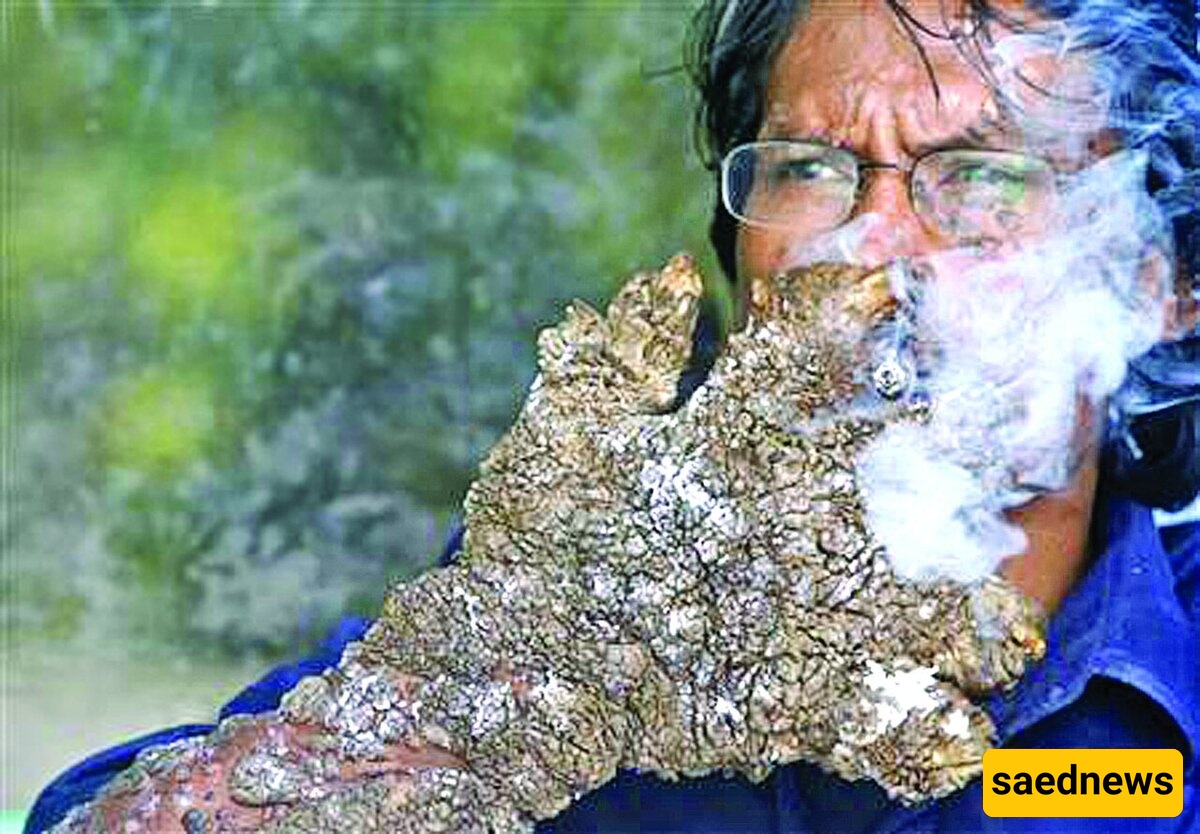 Bizarre Half-Human, Half-Tree Creature Discovered—Subhan Allah! [Images]