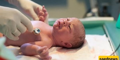 Iranian Women Resist Natural Childbirth and Embrace C-Sections! + Photos