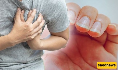 💔Doctor Reveals Surprising Nail Warning That Could Signal a Serious Heart Condition