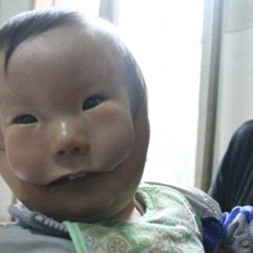 A Baby Born with a Mask on His Face! + Images