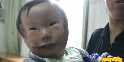 A Baby Born with a Mask on His Face! + Images