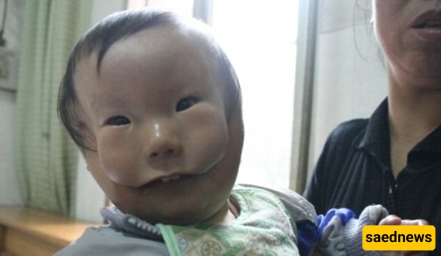 A Baby Born with a Mask on His Face! + Images