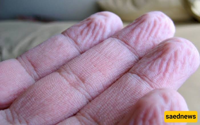 finger