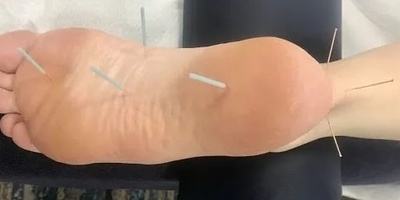 The Strange Woman Who Bleeds Nails and Needles from Her Legs