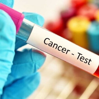 Health Ministry to Carry Out Comprehensive Cancer Screening Program