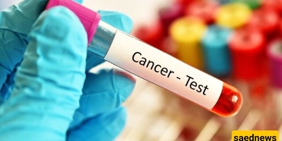 Health Ministry to Carry Out Comprehensive Cancer Screening Program