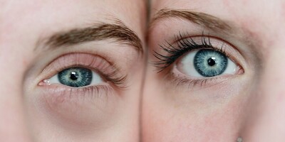 What Is The Meaning of Puffiness Around The Eyes?