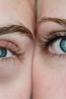 What Is The Meaning of Puffiness Around The Eyes?