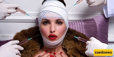 The Strangest Cosmetic Surgery Procedures in Iran