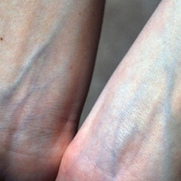 Why Are Veins Blue While Blood Is Red?