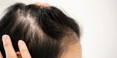 Habits That Silently Make Women’s Hair Thinner