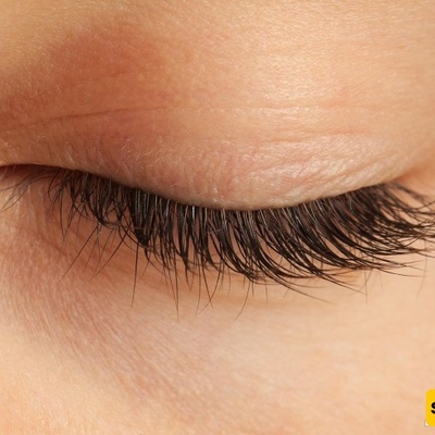 Natural Home Remedies for Treating Droopy Eyelids