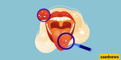 The Secrets Your Tongue Tells About Your Health!