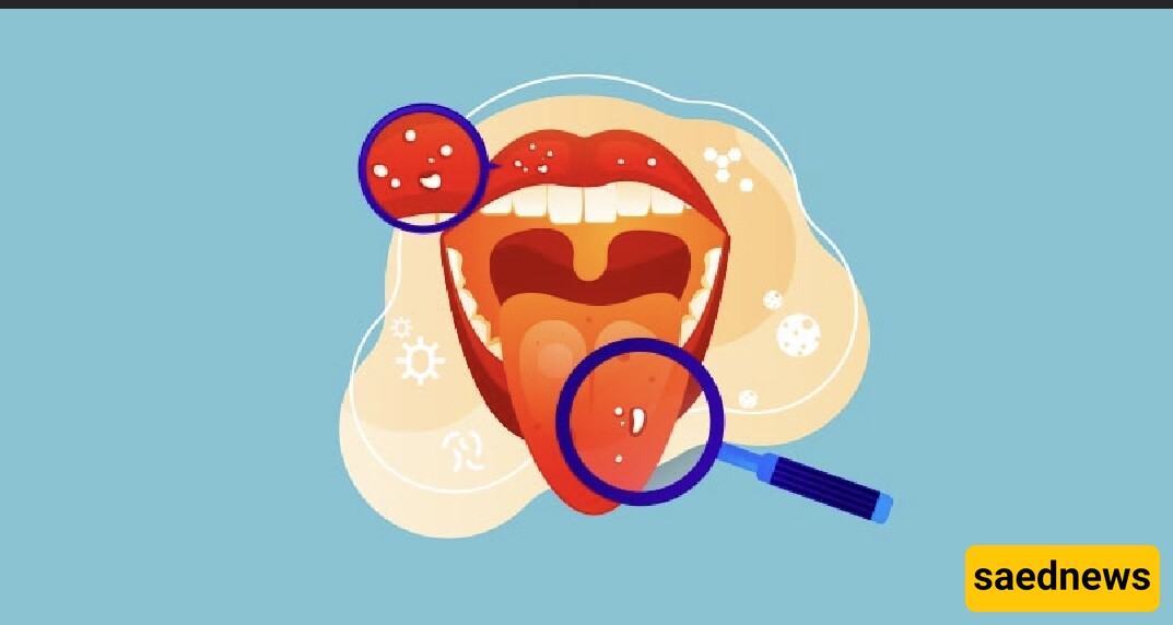 The Secrets Your Tongue Tells About Your Health!