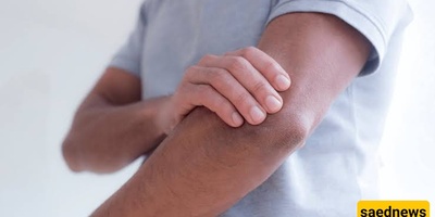 Why Do Elbows Tend To Be Rougher Than Other Parts Of The Arms?