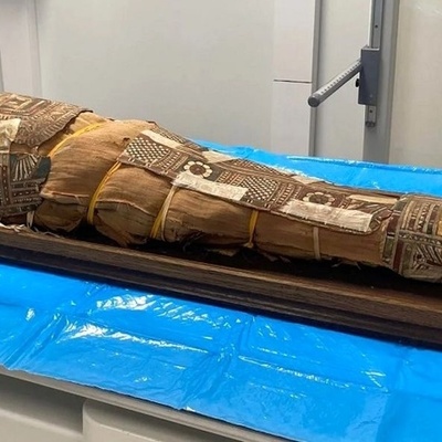 Discovery of an Unknown Object on the Chest of a 2,000-Year-Old Egyptian Child Mummy