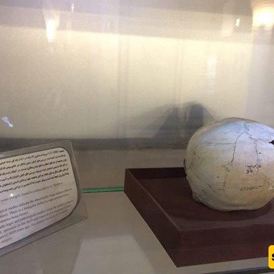 An Astonishing Archaeological Discovery That Transformed The History of Medicine In Iran