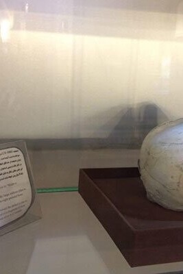 A groundbreaking archaeological find in Iran has reshaped our understanding of ancient medical history
