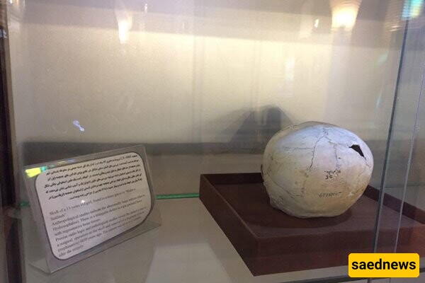 An Astonishing Archaeological Discovery That Transformed The History of Medicine In Iran