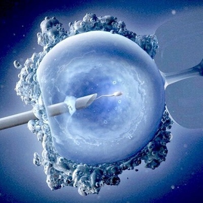 Everything You Need to Know About IVF for Infertility Treatment