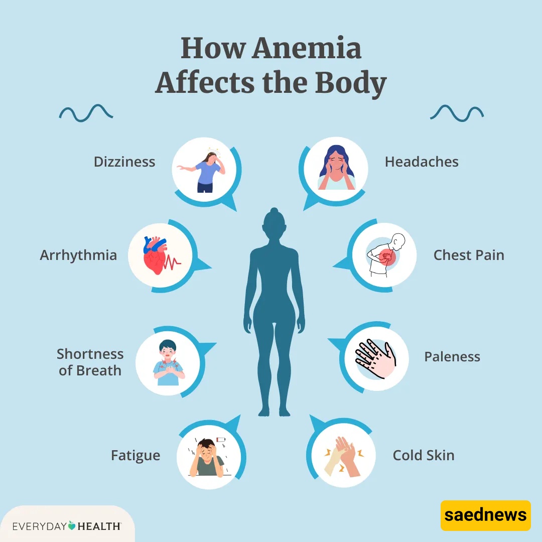 Iron Deficiency Anemia