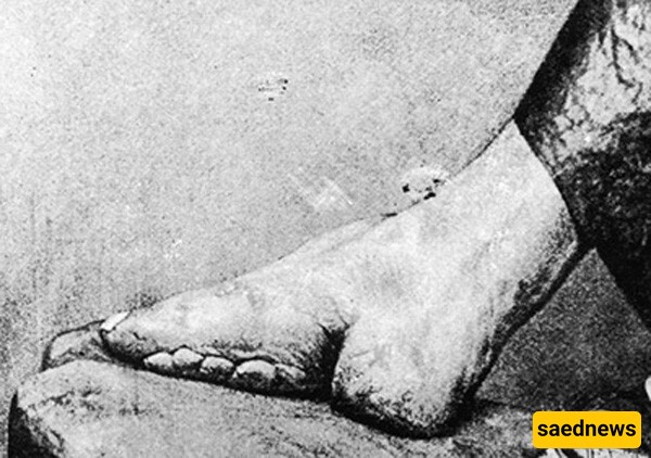 Foot Binding for Fashion