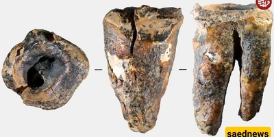A 60,000-Year-Old Tooth Suggests That Neanderthals Practiced Dentistry