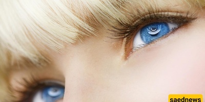 How to Reduce Eye Puffiness Caused by Crying