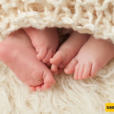 A Weirdly Shaped American Girl with Four Legs Who Worked in a Circus + Photo