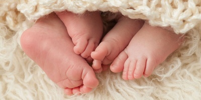 A Weirdly Shaped American Girl with Four Legs Who Worked in a Circus + Photo