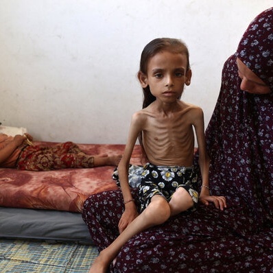 One Million Women, Girls Starving in Gaza: UN Says
