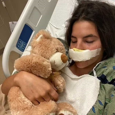 The Harrowing Story of a Young Model Whose Lip Was Torn Off by a Pit Bull