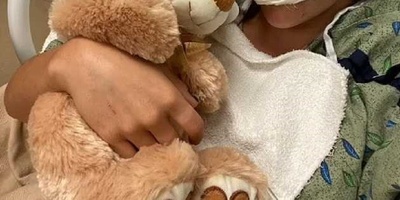 The Harrowing Story of a Young Model Whose Lip Was Torn Off by a Pit Bull