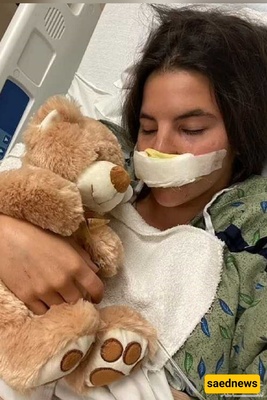 The Harrowing Story of a Young Model Whose Lip Was Torn Off by a Pit Bull